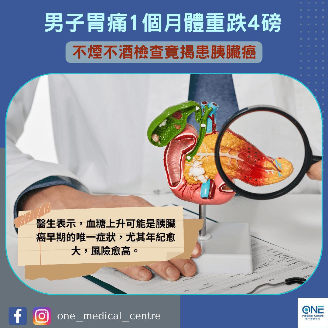 【癌症殺手 – 男子胃痛1個月體重跌4磅　不煙不酒檢查竟揭患胰臟癌】